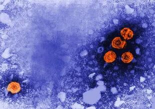 Imagen microscópica del virus que provoca la hepatitis A