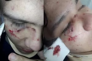 15 adolescentes golpearon y desfiguraron a un alumno que salía de la escuela
