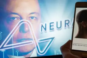 Elon Musk anuncia el primer implante de un chip cerebral inalámbrico de Neuralink