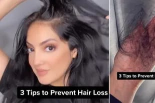 Los consejos de una mujer para prevenir la caída del cabello