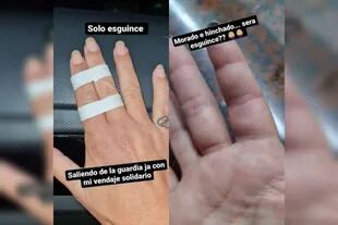 Farro se lesionó los dedos (Foto Instagram @moni.farro)