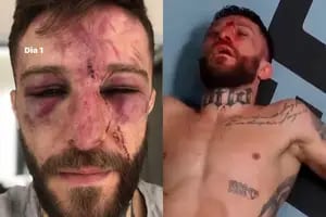 UFC. El terrible KO al argentino Pitbull Rojo y su video tras la paliza