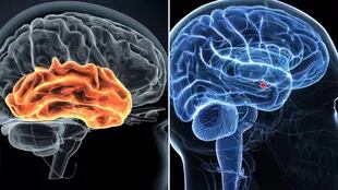 Los estudios indicaron una interacción entre la corteza auditiva (izq.) y la amígdala (der.)