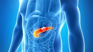 El cáncer de páncreas es de los más agresivos y tiene pocas opciones de tratamiento más modernas y menos invasivas.