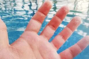 Pasa de uva: por qué la piel de los dedos se arruga en el agua