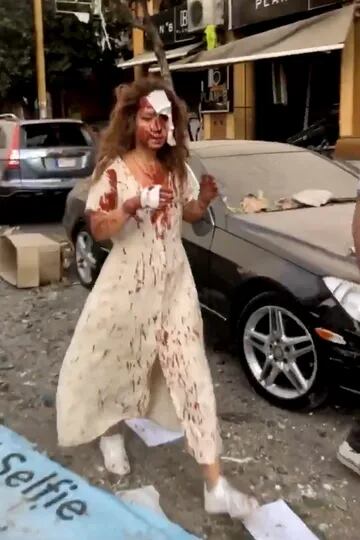 Una mujer herida camina por las calles de Beirut luego de la gran explosión que afectó a esa ciudad
