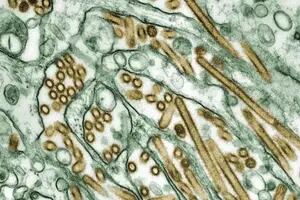 La OMS advirtió sobre un virus con alta posibilidad de propagación entre los humanos