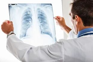 El cáncer de pulmón es el que más decesos causa anualmente