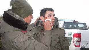 El subalférez Echazú sufrió una lesión en el rostro el día del operativo