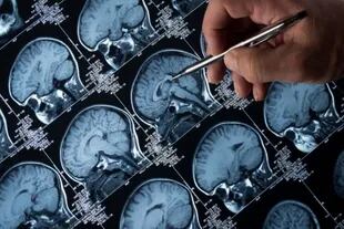 La epilepsia es considerada uno de los trastornos neurológico más comunes, con aproximadamente 50 millones de personas diagnosticadas en todo el mundo 