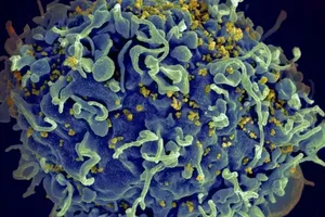 Por qué no debe alarmarnos la mutación más virulenta del VIH que fue descubierta