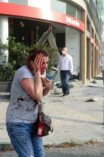 Una mujer herida por la explosión en Beirut