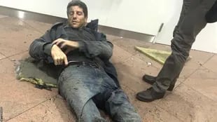 Una foto que dio la vuelta al mundo: Bellin, herido en el suelo tras la explosión