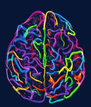 Cerebro humano.