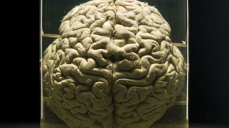 El cerebro no un tiene un aspecto precisamente... romántico