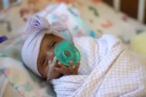 Nació la bebé más prematura del mundo: pesa lo mismo que una manzana
