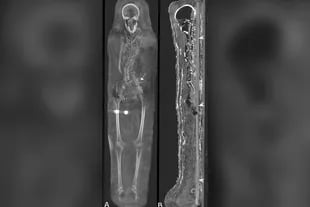 Las radiografías tomadas a las momias revelaron datos ocultos