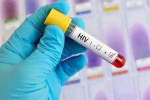 VIH-sida: probarán en el país una vacuna preventiva en 600 jóvenes voluntarios