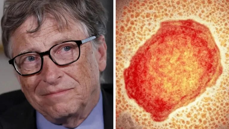 A previsão que Bill Gates fez sobre a varíola que pode estar perto de se tornar realidade