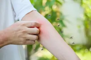 Por qué los mosquitos pican más a algunas personas que a otras