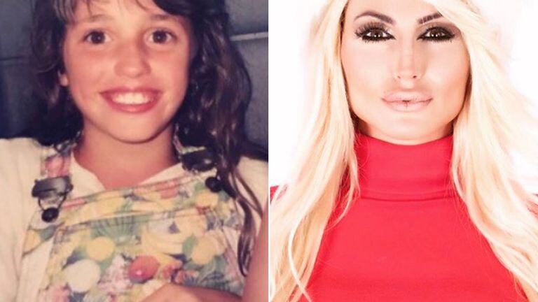 Vicky Xipolitakis, antes y después