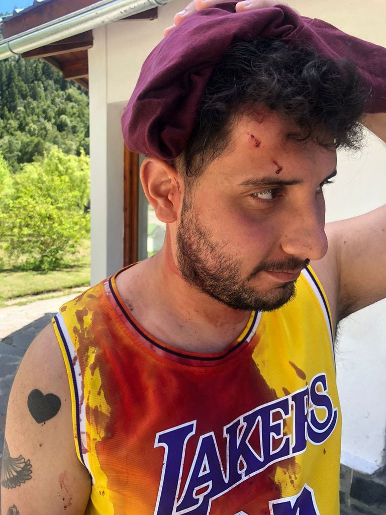 Dos jóvenes fueron agredidos por encapuchados frente al corte de la Ruta 40 en Villa Mascardi