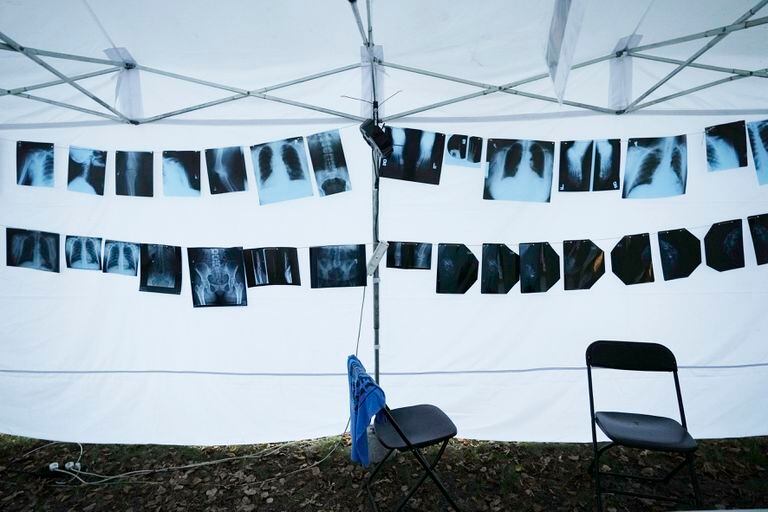 ARCHIVO - Placas de rayos X colgados en una tienda de campaña que forma parte de un campamento de protesta en Varsovia, Polonia, el 21 de septiembre de 2021. (AP Photo/Czarek Sokolowski)