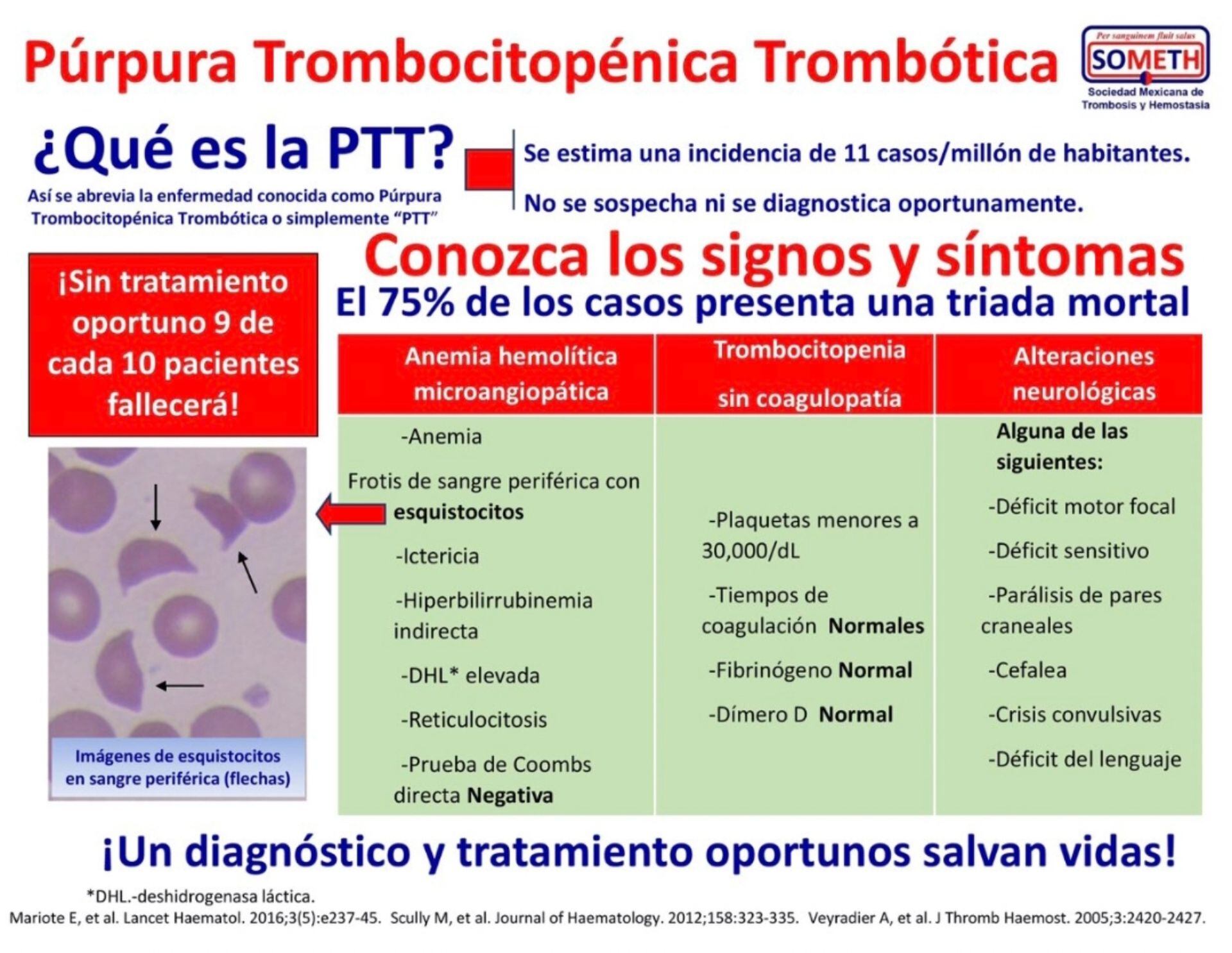 La Púrpura Trombocitopénica Trombótica es una enfermedad hematológica muy compleja.