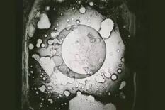 La primera foto de la Luna, sacada hace 181 años