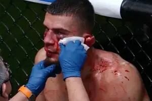 Escalofriante: el combate que se detuvo cuando un peleador casi pierde una oreja