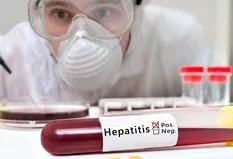 Cacería mundial para detectar al culpable de la hepatitis aguda que desconcierta a los científicos