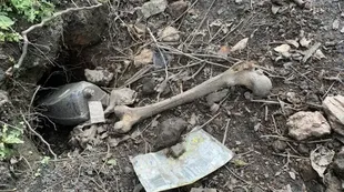 Ann Mathers found the remains of human bones in her yard in Dudley