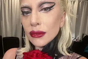Lady Gaga, criticada por una “vergonzosa” campaña de promoción de medicamentos para la migraña