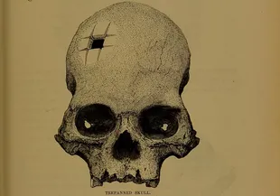 El cráneo, que data de entre 1400 y 1530 d.C., apareció dibujado así en el libro de Squier