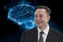 El trastorno que ayudó a Elon Musk a convertirse en uno de los hombres más ricos del mundo
