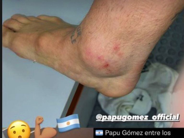 El tobillo de Papu Gómez y un rosario de ausencias en la selección para el partido contra Colombia