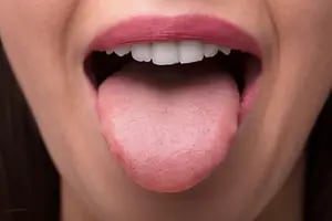 Afirman que la lengua puede anticiparte un problema de salud