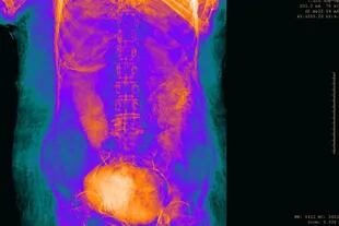 Cuando los investigadores realizaron las tomografías computarizadas de la momia de Tebas, se sorprendieron al encontrar los restos de un feto en su abdomen