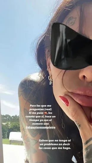 Candelaria Tinelli se refirió a su nueva cirugía estética (Foto: Instagram)