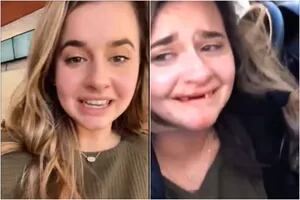 Una usuaria de TikTok perdió varios dientes tras sumarse a un desafío viral
