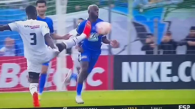 Le brutal coup de pied de Coupe de France qui a laissé un joueur à l’hôpital