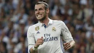 La dentadura más blanca de Gareth Bale
