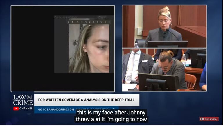 Amber Heard mostró una foto de una herida en su cara cuando Johnny Depp supuestamente le arrojó un teléfono
