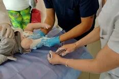 Un programa médico elimina sin cirugía una malformación frecuente en bebés y la discapacidad asociada
