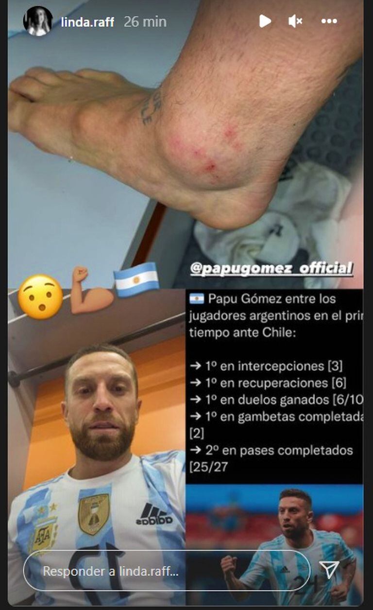 El post de Instagram en el que se ve cómo quedó el tobillo de Alejandro Gómez