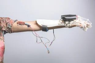 Órtesis de brazo desarrollada en Shenzhen, China, que se conecta al sistema nervioso del usuario.