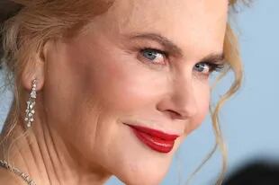  Nicole Kidman aseguró que no se hizo cirugías, pero si probó el bótox 