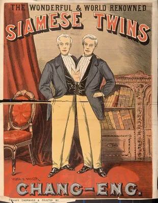 Los hermanos se hicieron célebres como los "Siamese Twins" en un circo que recorría los Estados Unidos.