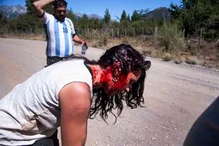 Celeste Fierro, dirigente del MST, sufrió heridas cortantes en la cabeza