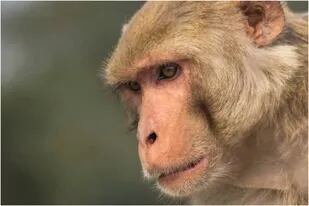 Viruela del mono: 5 preguntas sobre la enfermedad que causa alerta a nivel mundial